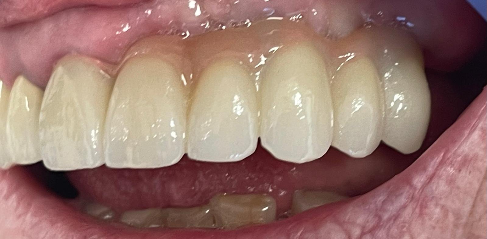 Cras accumsan nulla nec lacus ultricies placerat.